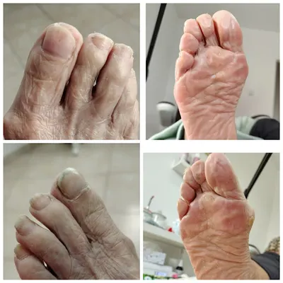 Podologia i stylizacja paznokci HAPPY FEET CLINIC Magdalena Kondera